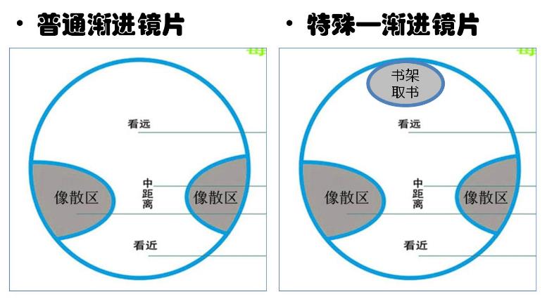 漸進(jìn)多焦鏡的原理與應(yīng)用，3個光區(qū)，看遠(yuǎn)近只需一副